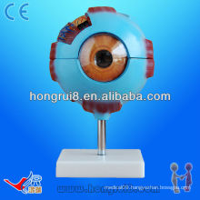 ISO Detachable Eyeball model, Anatomy Model of Amplified Eyeball
